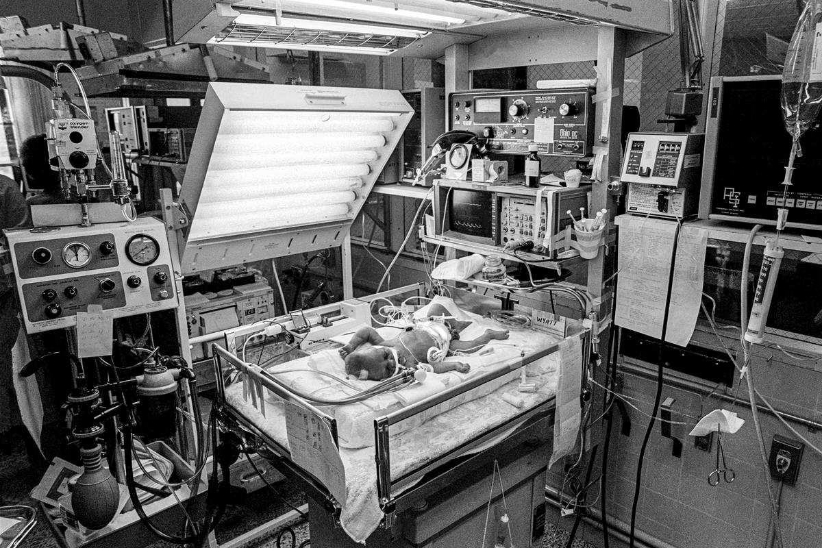 Preemie Baby unit at St Joseph's Hospital. I.C.U. The technology in a modern hospital. Showing IV Pump. Cardiac & Respiratory monitor. Respirator. Umbilical catheter in navel. 3 Electrodes for heart & respiratory rate, endotracheal tube in nose. Preemie baby under 2 lb at birth.