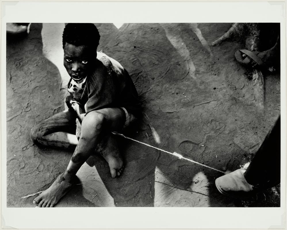 Demented Boy, Sudan, 1988