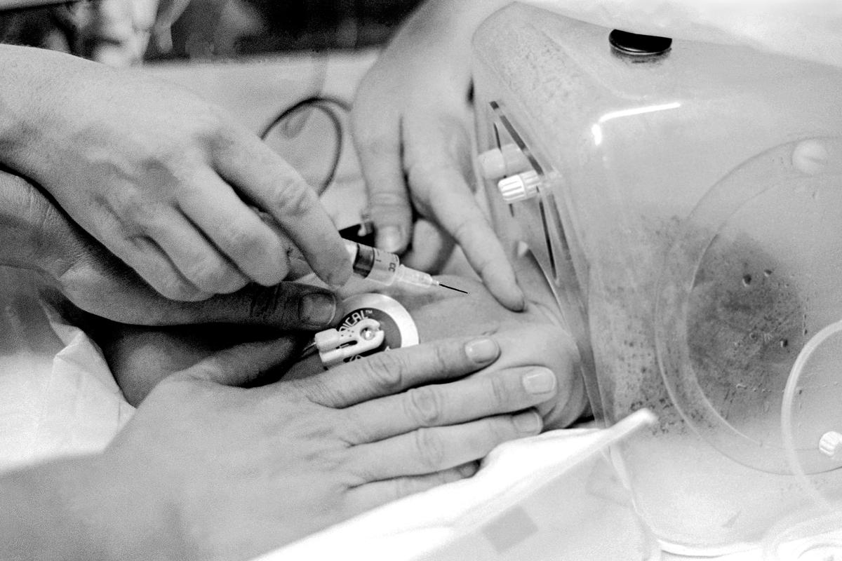 Preemie Baby unit at St Joseph's Hospital. I.C.U. Isolette. Preemie baby with head in a humidifier is injected to help stabilise it's condition. Phoenix, Arizona USA
