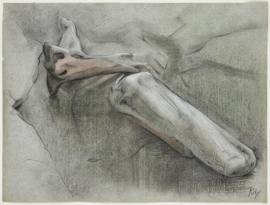 Bones