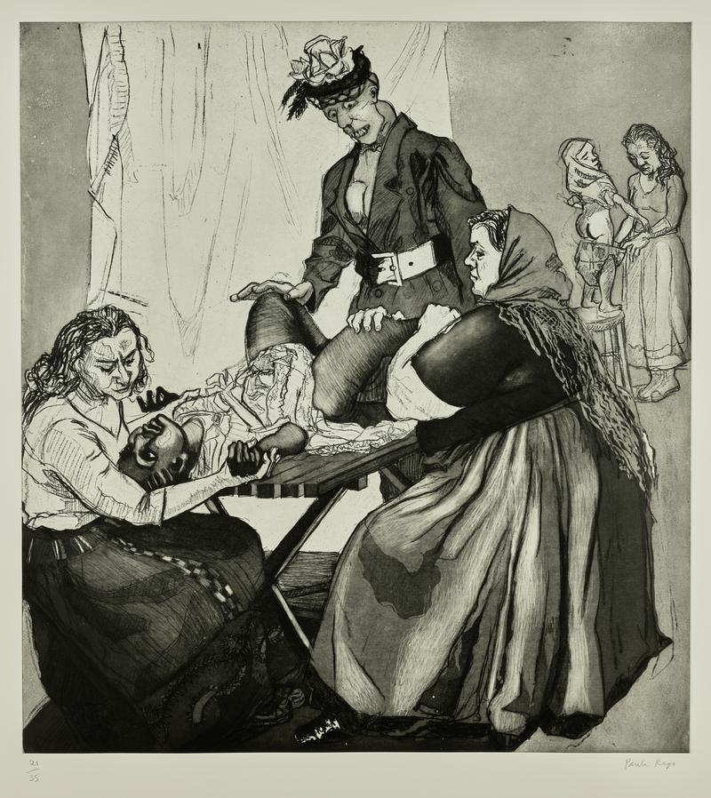 Circumcision