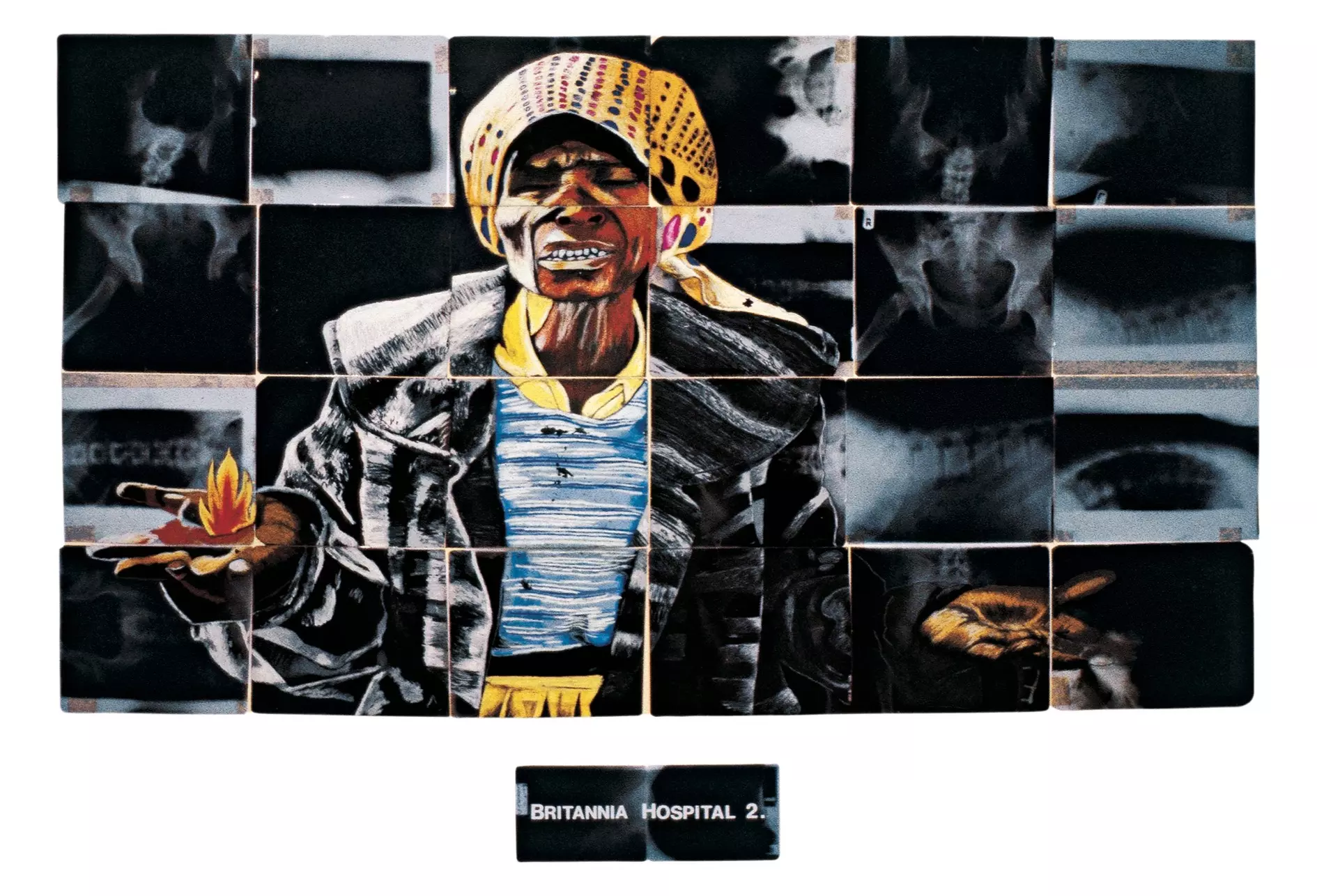 Ysbyty Britannia 2, 1988